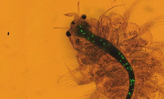 Entenda como microplásticos representam riscos à saúde das pessoas e do planeta